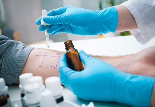 Ein Arzt führt einen Allergietest auf dem Arm eines Patienten durch